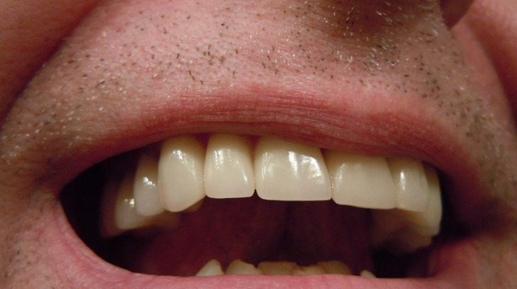 White Teeth Home Remedies: पीले दांतों से छुटकारा पाने के लिए अपनाएं ये घरेलु उपाय