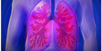 Lung Cancer Symptoms: फेफड़ों के कैंसर के लक्षण, कारण और इलाज