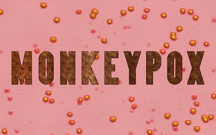 Monkeypox Virus Symptoms मंकीपॉक्स क्या है जानिए इसके लक्षण और कैसे फैलता है ये वायरस