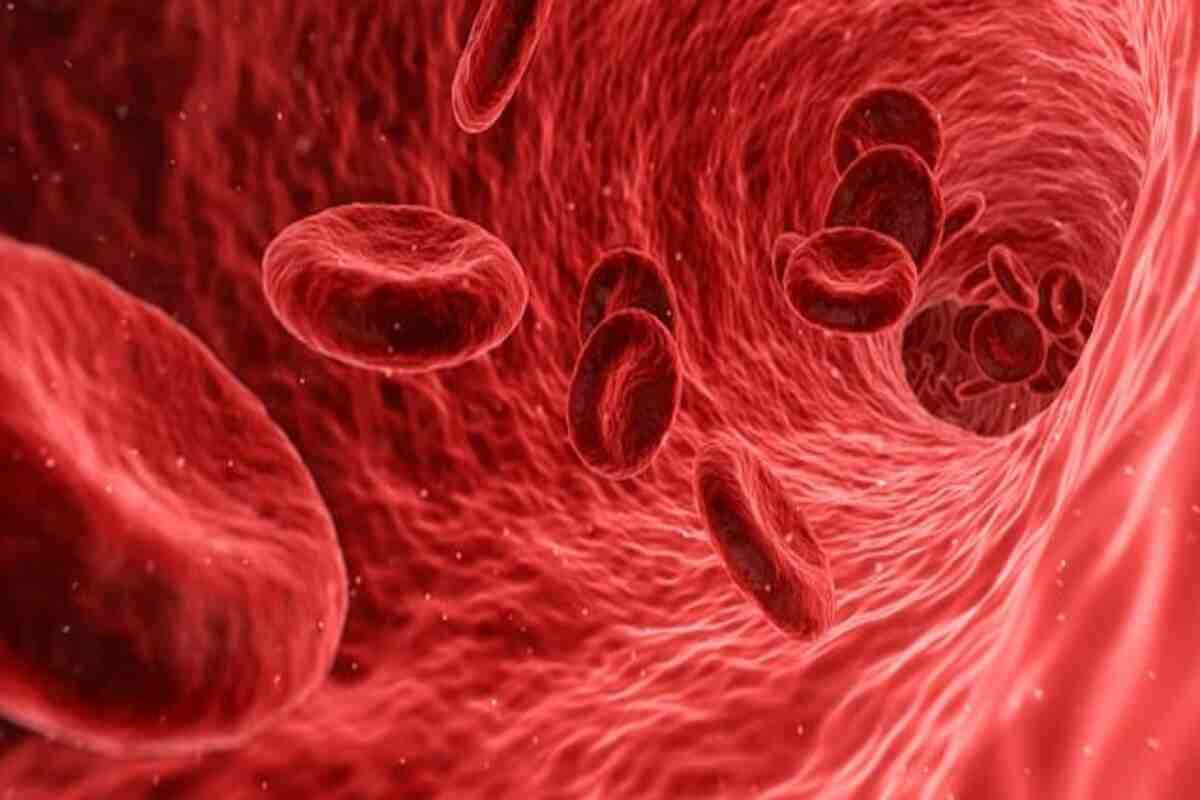 Anemia: खून की कमी (एनीमिया) के लक्षण, कारण और उपाय (Image Credit: Pixabay)
